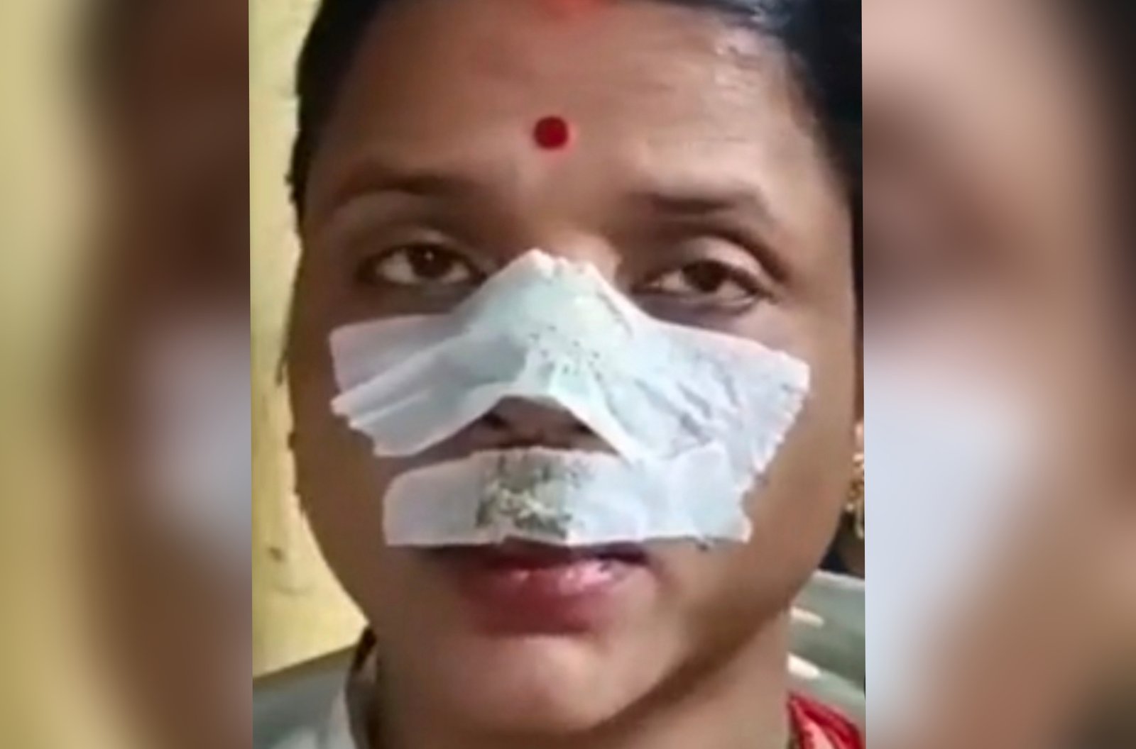 Gorakhpur News: करवा चौथ की पूजा कर रही महिला की नाक में लगी गोली, छत पर मची चीख-पुकार